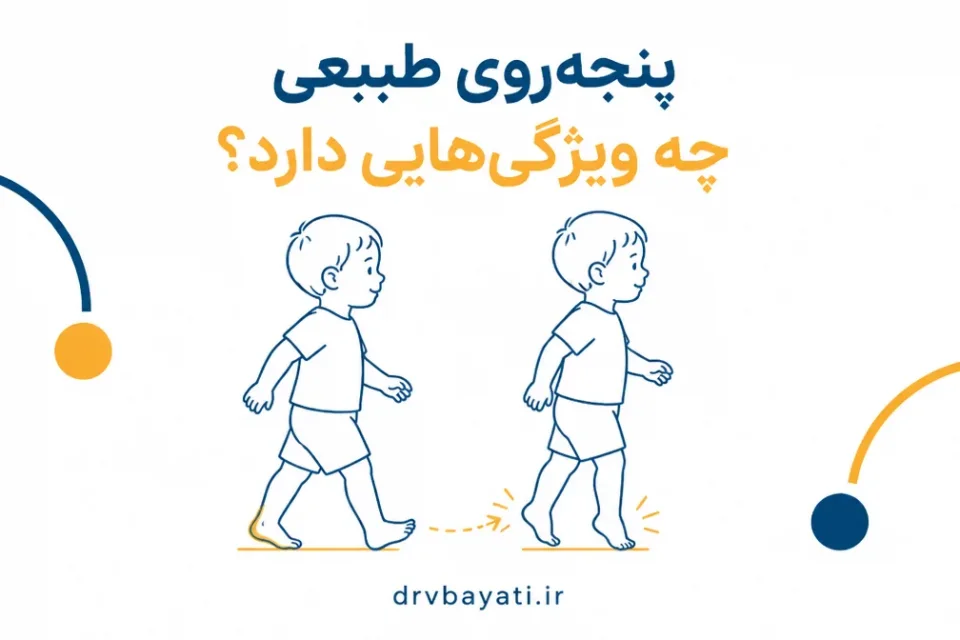 پنجهروی طبیعی چه ویژگیهایی دارد — مقایسه راه رفتن طبیعی کودک با پنجهروی گذرا در سنین نوپایی